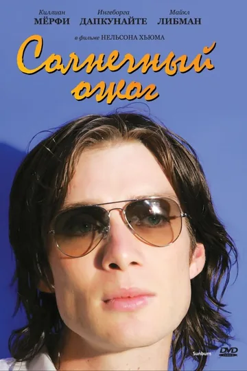 Солнечный ожог